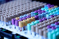 LIVVE Blood Test Female Hormone